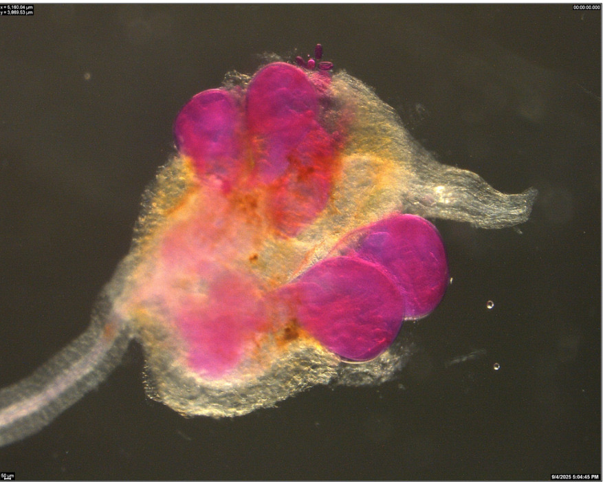 This image shows the female Northern root-knot nematode, Meloidogyne hapla (red structure), infecting bean roots. (Image credit: Pallavi Shakya)