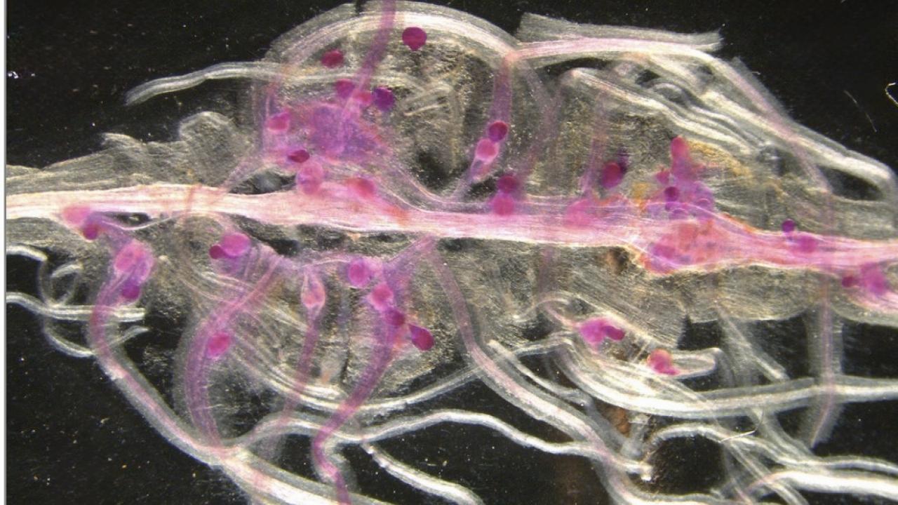 This image shows the Northern root-knot nematode, Meloidogyne hapla, infecting bean roots. The red-stained structures are female nematodes. (Image credit: Pallavi Shakya)